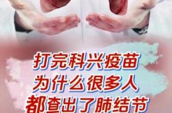 北京科兴疫苗对人体肺部有影响吗（科兴疫苗对人体的影响最新消息）