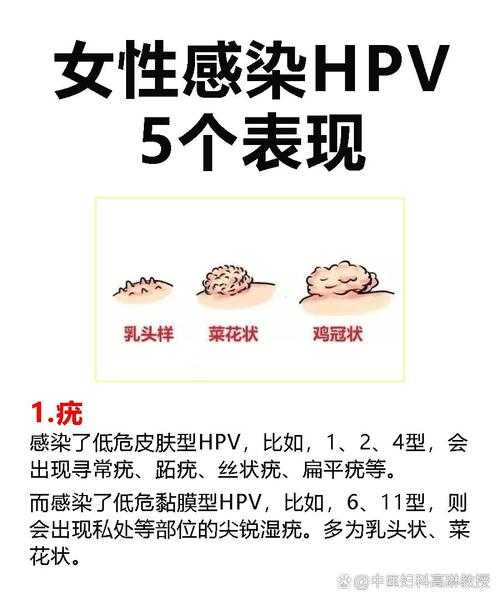 什么是无症状感染者?（感染hpv有什么症状）
