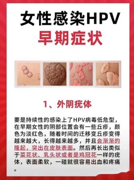 感染奥密克戎有什么症状和感觉(感染hpv有什么症状)