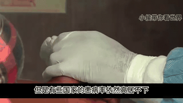 南非一艾滋病患者同时感染新冠(南非艾滋病)