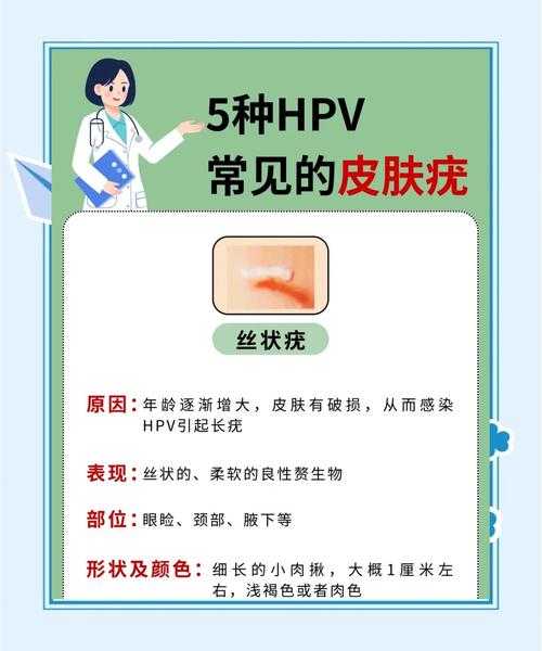 身上5种疣可能是HPV感染（身上长疣就一定是hpv感染了吗）