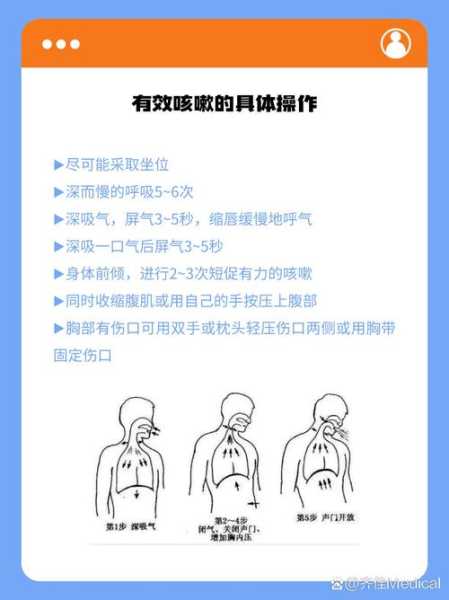 新冠咳嗽怎么办最快最有效缓解（新冠后期咳嗽怎么办）
